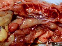 Budgerigar nestling (Melopsittacus undulatus) with multiple hemorrhages and pale organs in the coelomic cavity due to Polyomavirus infection (confirmed by PCR) Budgerigar nestling (Melopsittacus undulatus) with multiple hemorrhages and pale organs in the coelomic cavity due to Polyomavirus infection (confirmed by PCR)